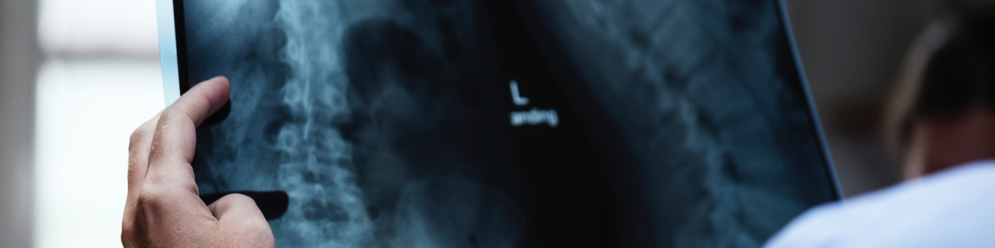 close-up image of a chest X-ray 